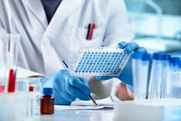 Researcher Sample Analysis and writes down the data result of for elisa analysis. Scientist working with samples panel microplate and registering data for diseases diagnostic in the laboratory